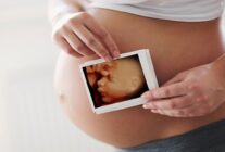 Dört Boyutlu Ultrason İçin Hazırlık ve Uygulama Süreci